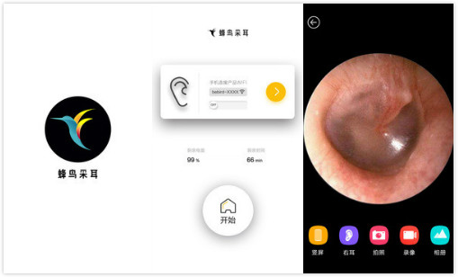 蜂鸟采耳app：一个可以高清查看耳道情况的工具